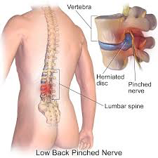 Back pain anotomy