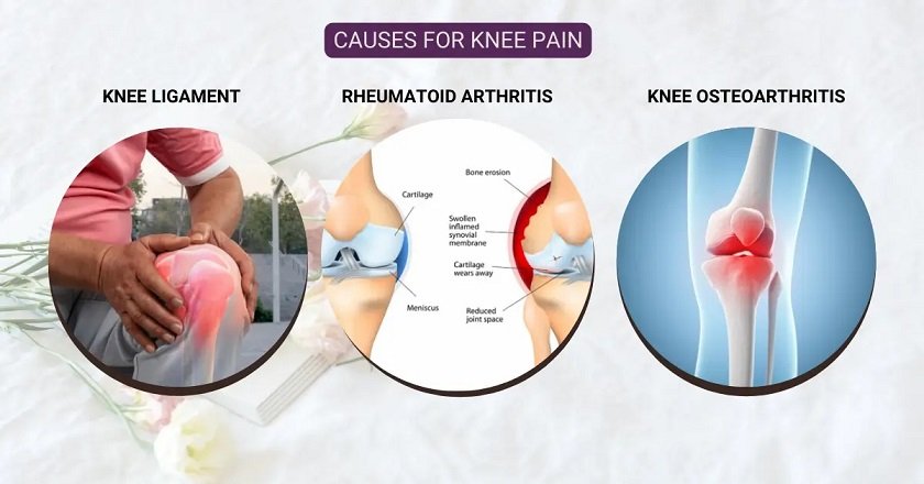 Causes for Knee Pain