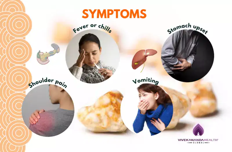Symptoms of Gall Bladder Stones